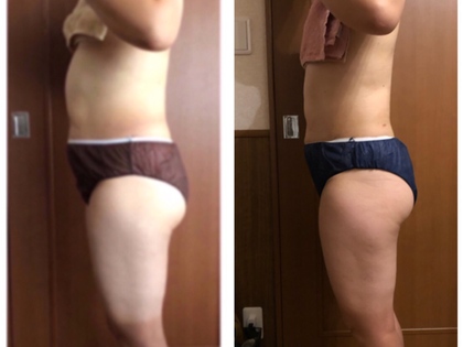 集中ダイエットコース